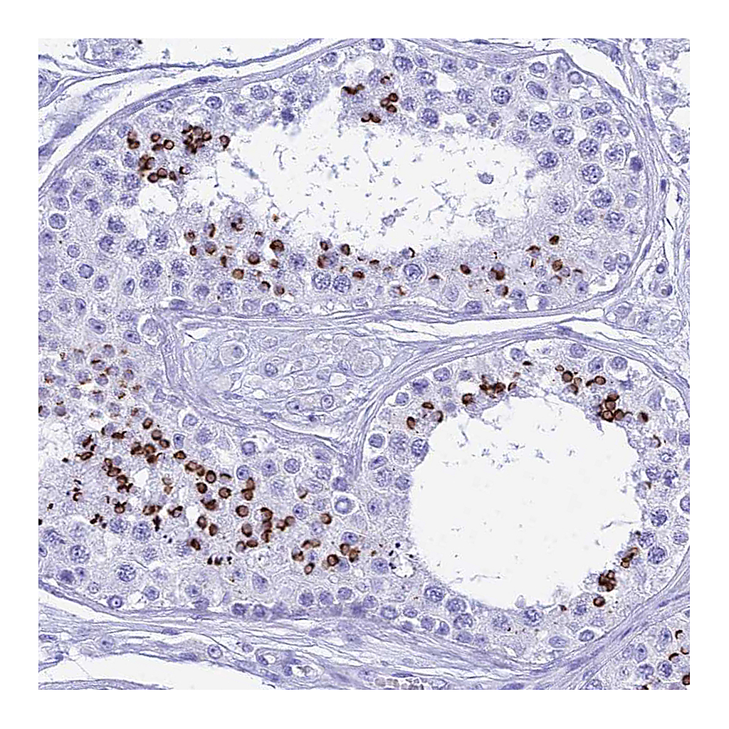 Atlas Antibodies Anti-PATE4 Antibody