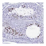 Atlas Antibodies Anti-PATE4 Antibody
