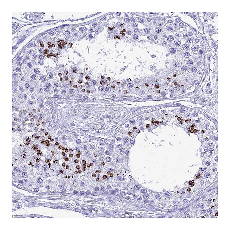 Atlas Antibodies Anti-PATE4 Antibody