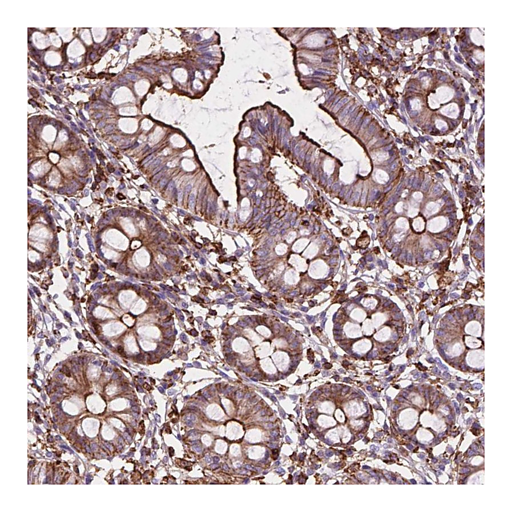 Atlas Antibodies Anti-PATJ Antibody
