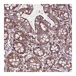 Atlas Antibodies Anti-PATJ Antibody
