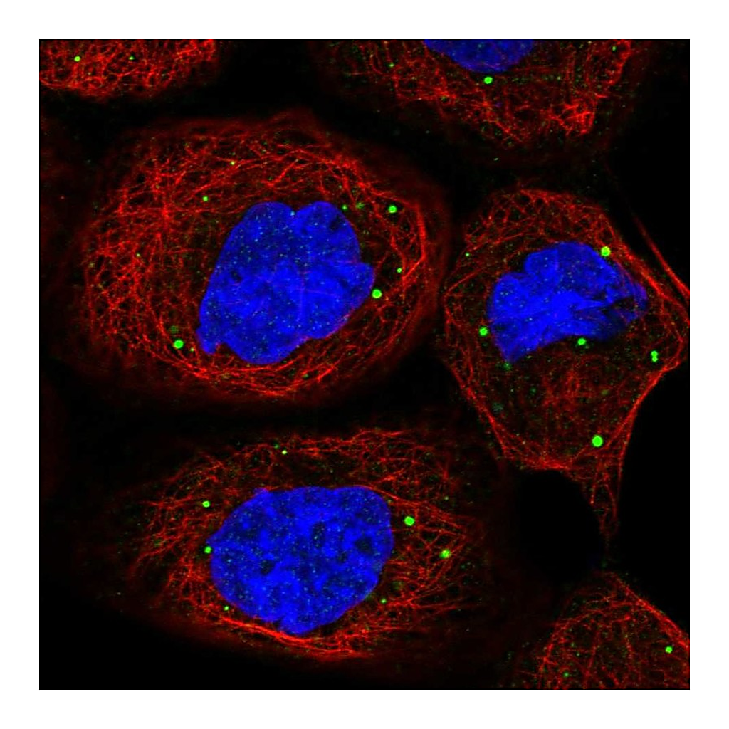 Atlas Antibodies Anti-PATL1 Antibody