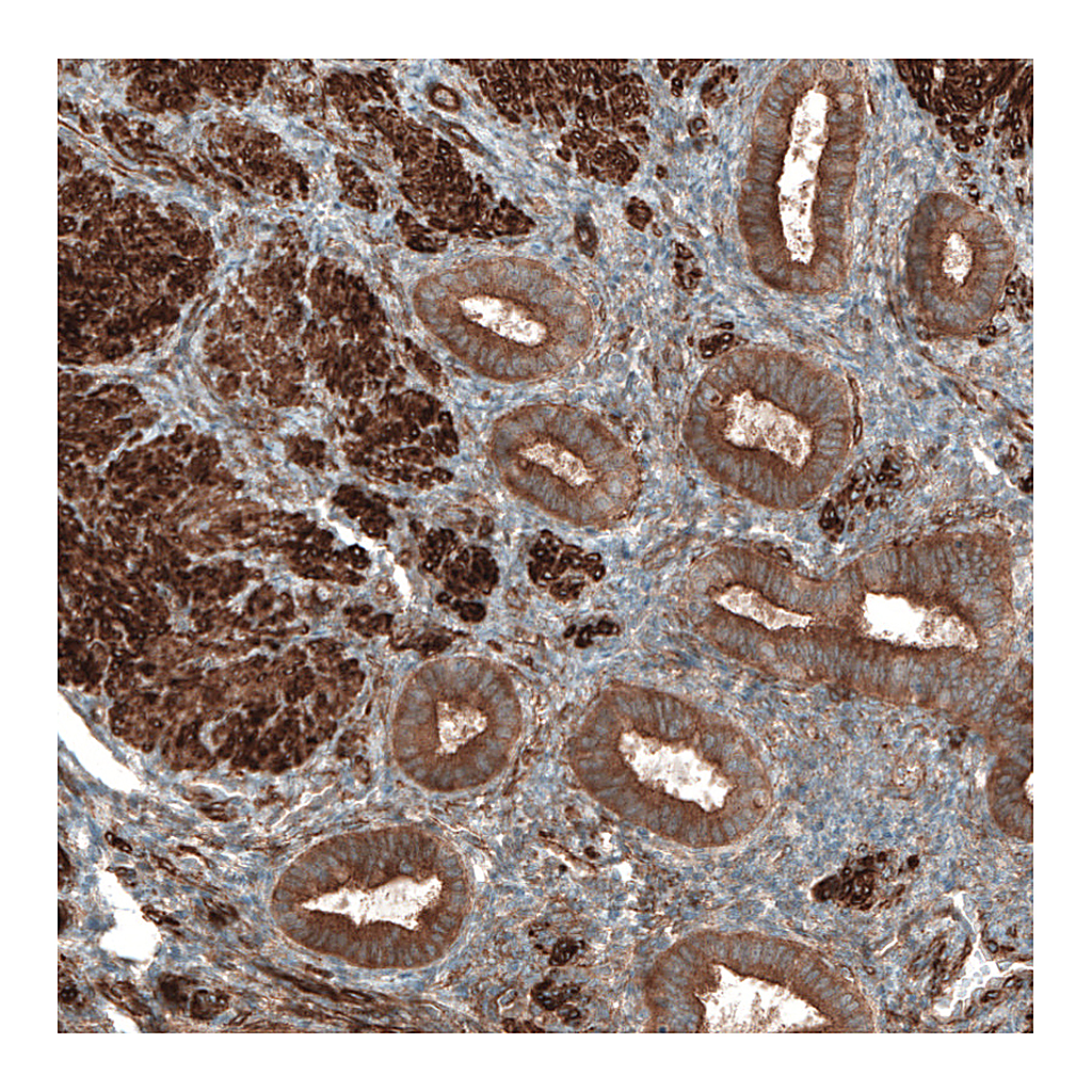 Atlas Antibodies Anti-PAWR Antibody