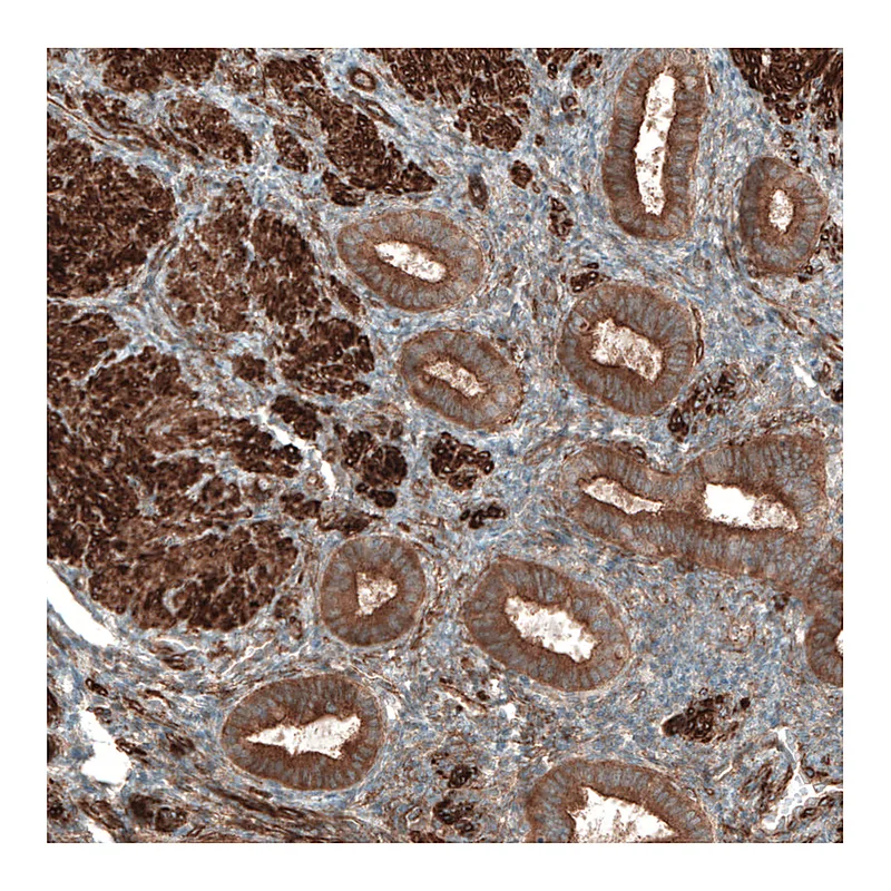 Atlas Antibodies Anti-PAWR Antibody