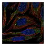 Atlas Antibodies Anti-PATL1 Antibody
