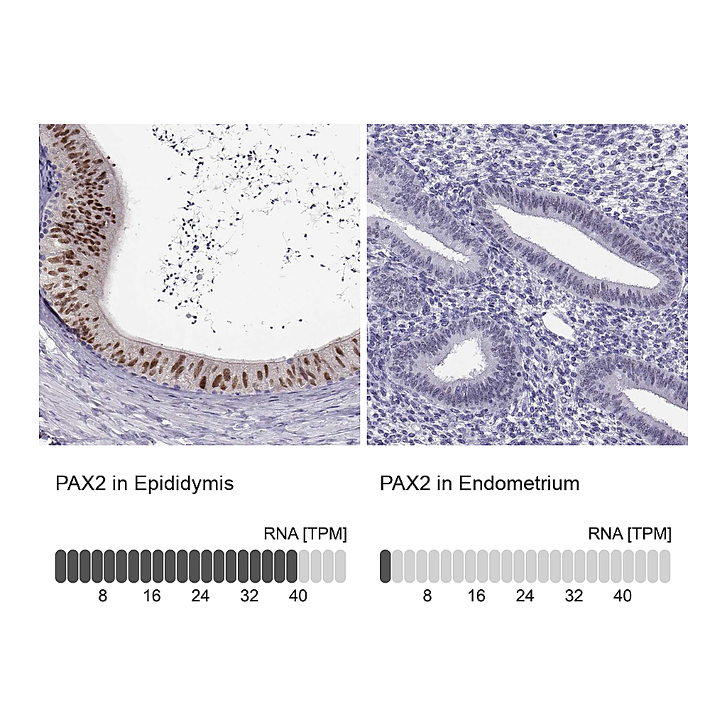 Atlas Antibodies Anti-PAX2 Antibody