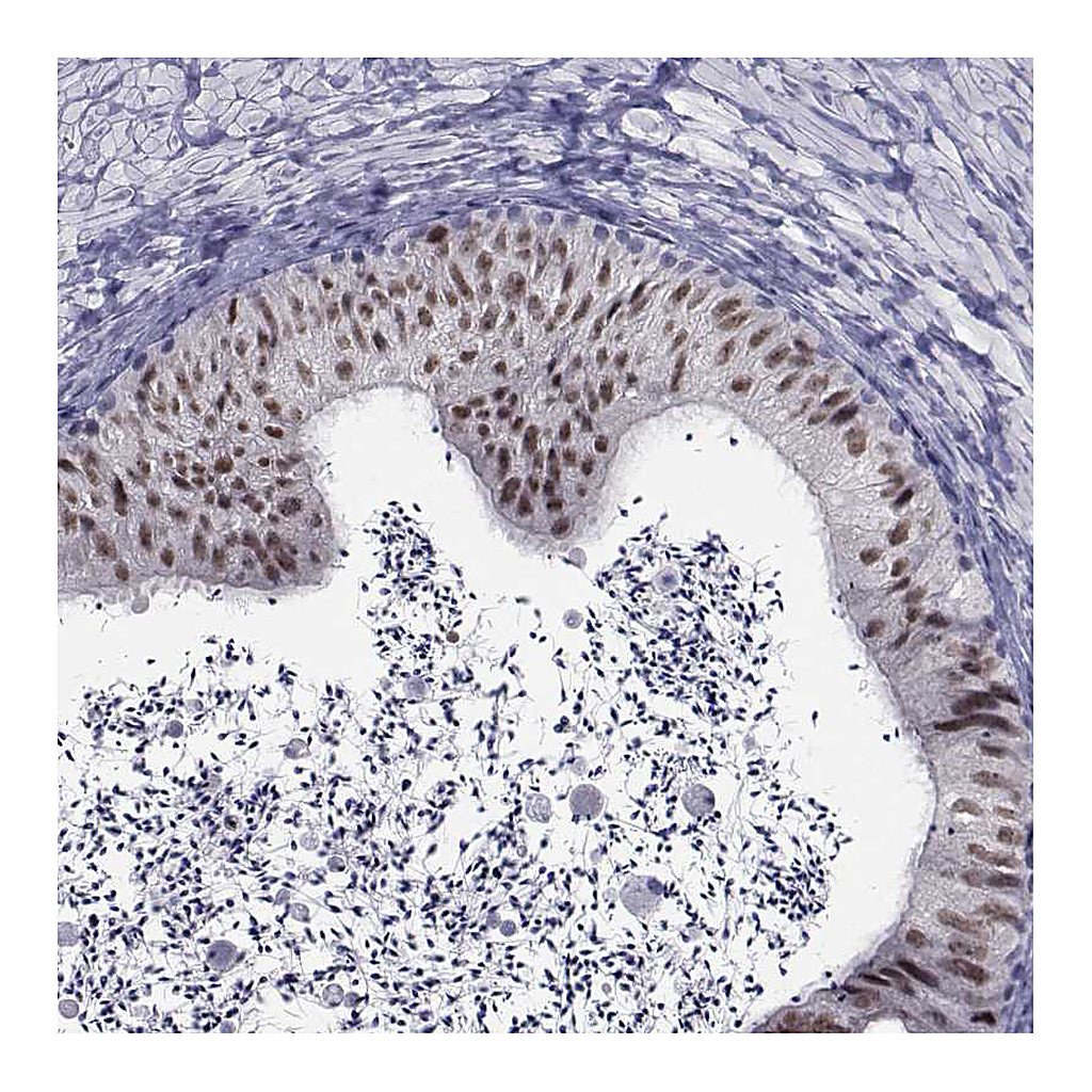 Atlas Antibodies Anti-PAX2 Antibody