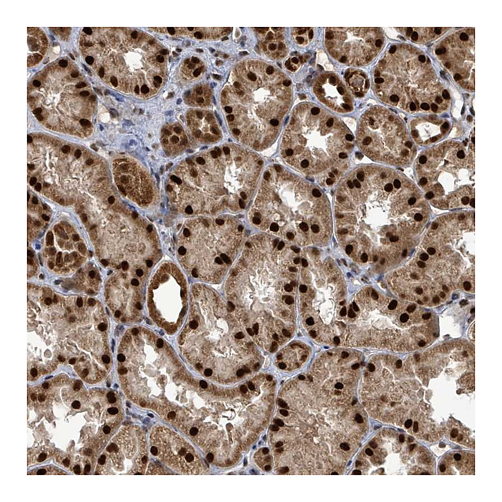 Atlas Antibodies Anti-PATZ1 Antibody