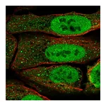 Atlas Antibodies Anti-PAX5 Antibody
