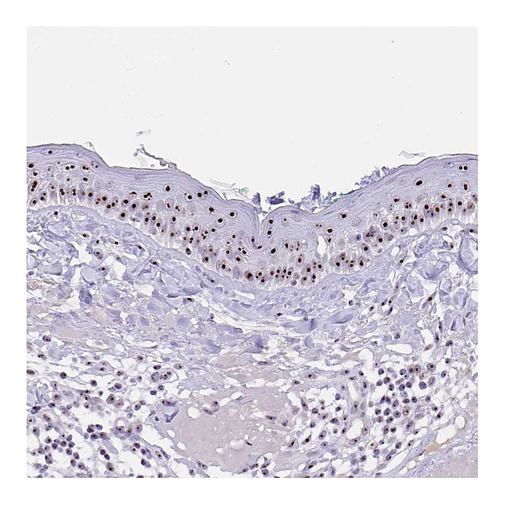 Atlas Antibodies Anti-PAX3 Antibody