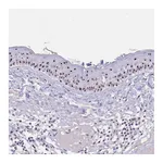 Atlas Antibodies Anti-PAX3 Antibody