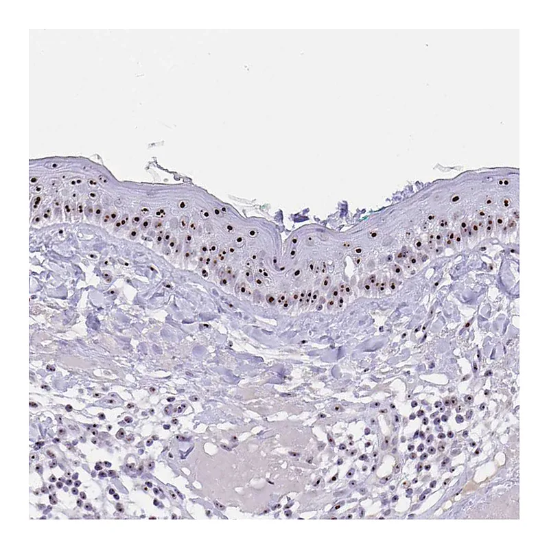 Atlas Antibodies Anti-PAX3 Antibody