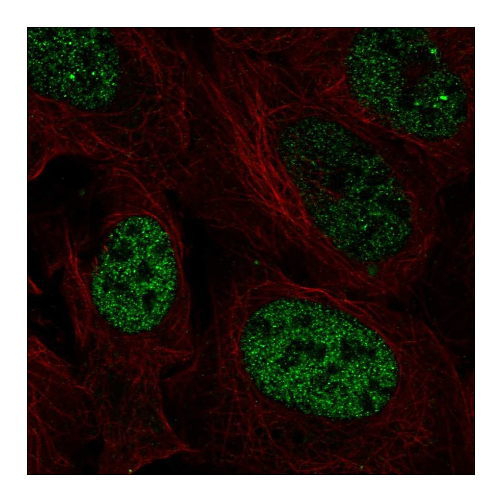 Atlas Antibodies Anti-PAX3 Antibody
