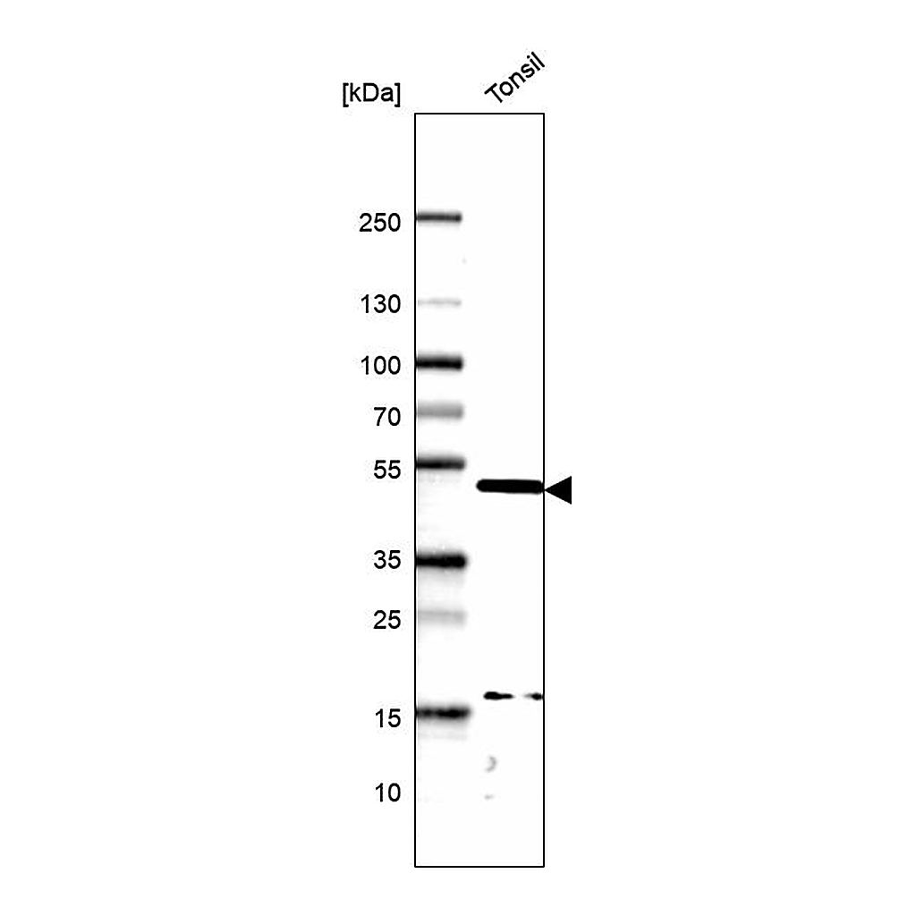 Atlas Antibodies Anti-PAX5 Antibody