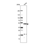 Atlas Antibodies Anti-PAX5 Antibody