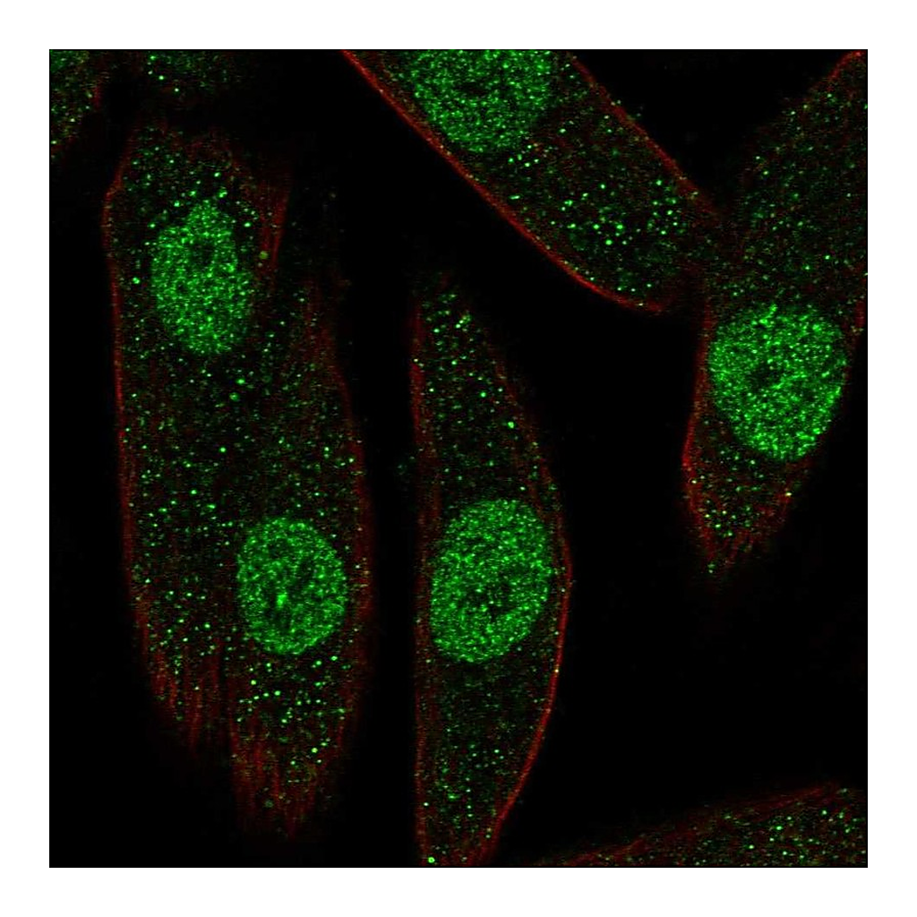 Atlas Antibodies Anti-PAX8 Antibody