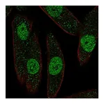 Atlas Antibodies Anti-PAX8 Antibody
