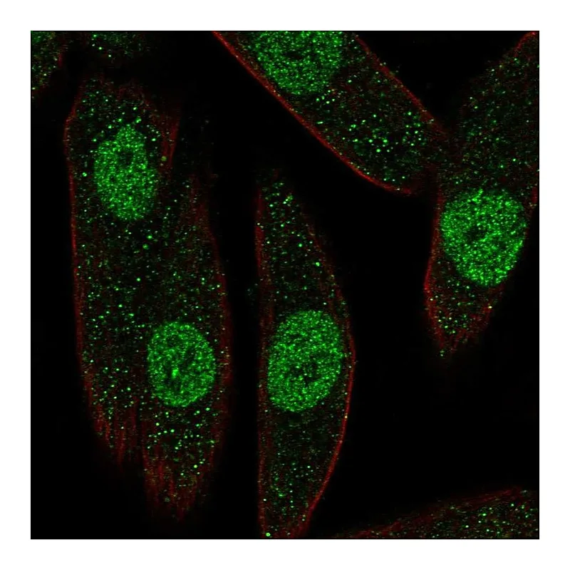 Atlas Antibodies Anti-PAX8 Antibody