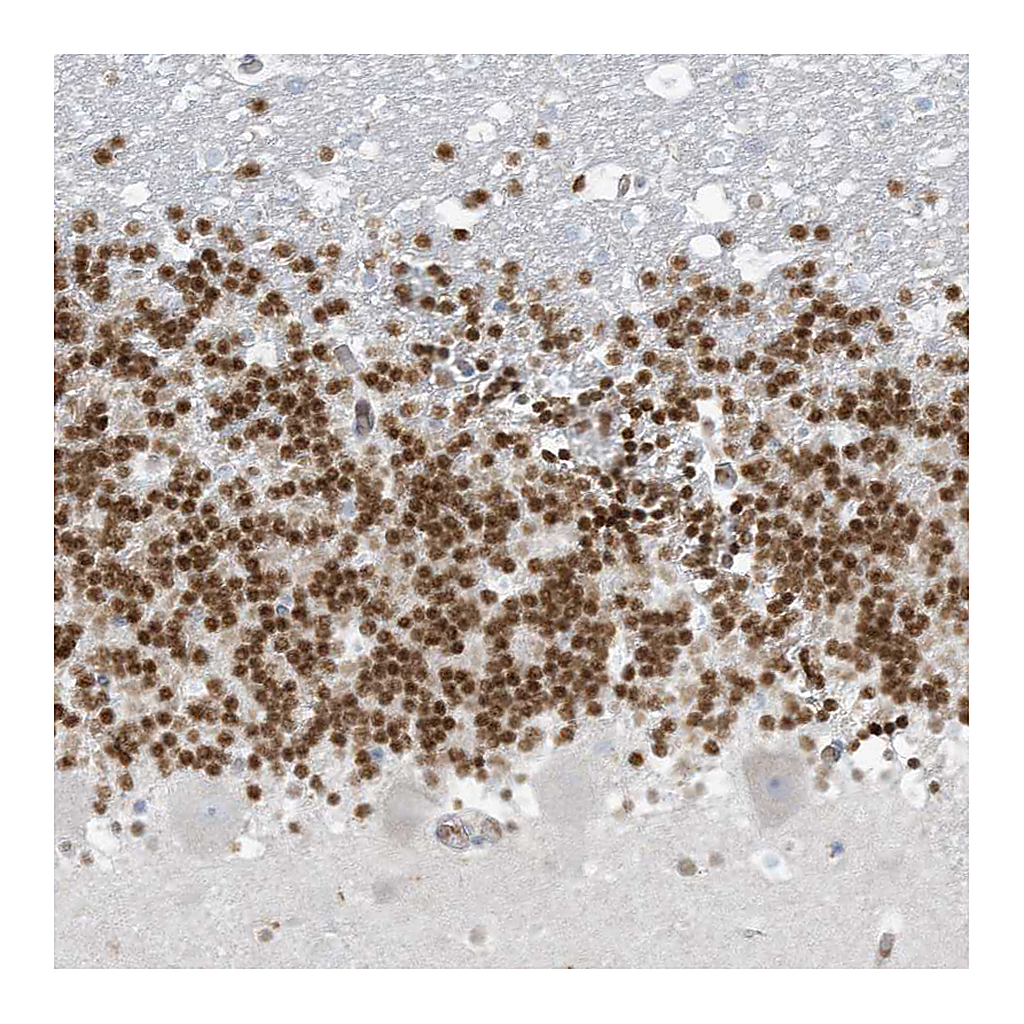 Atlas Antibodies Anti-PAX6 Antibody