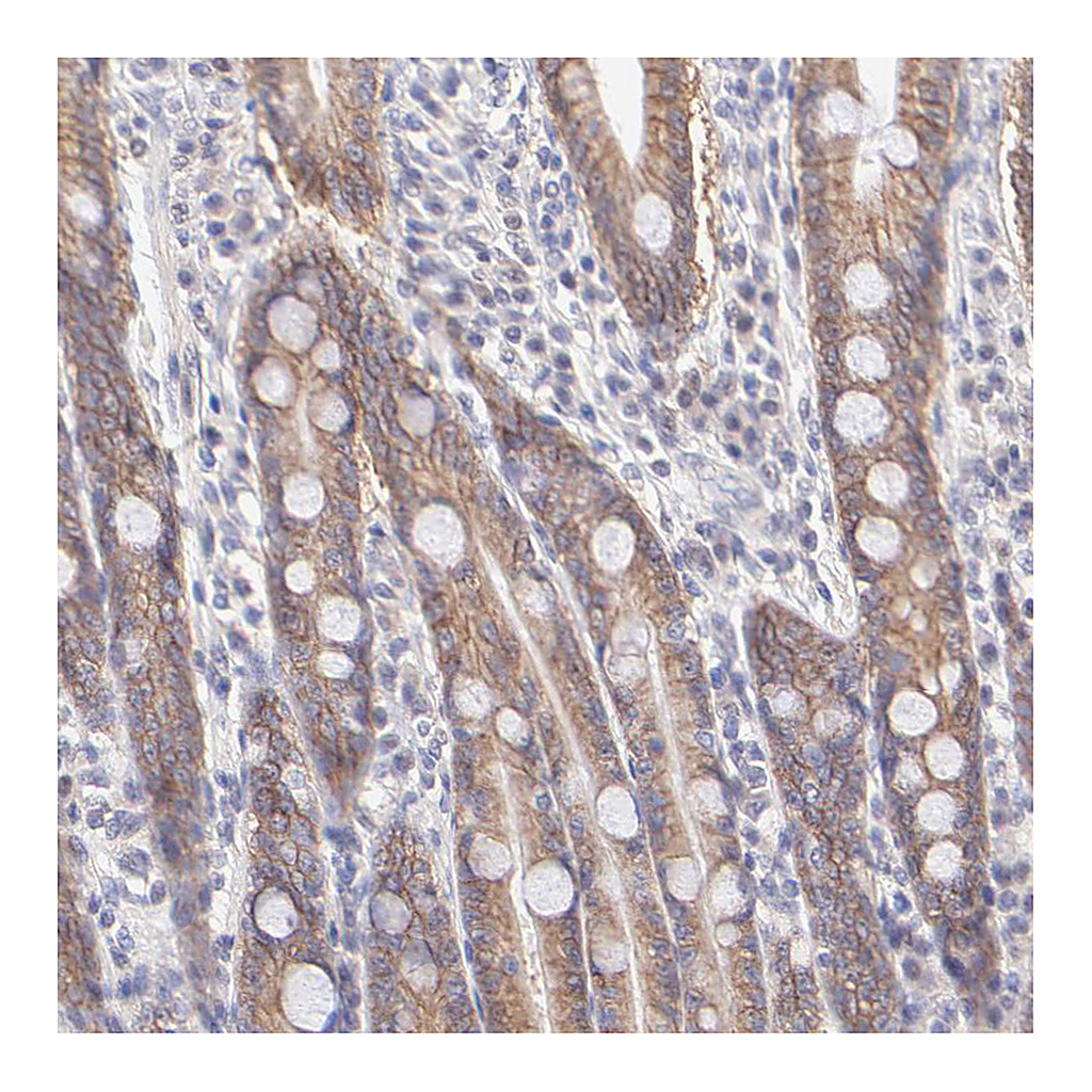 Atlas Antibodies Anti-PBDC1 Antibody