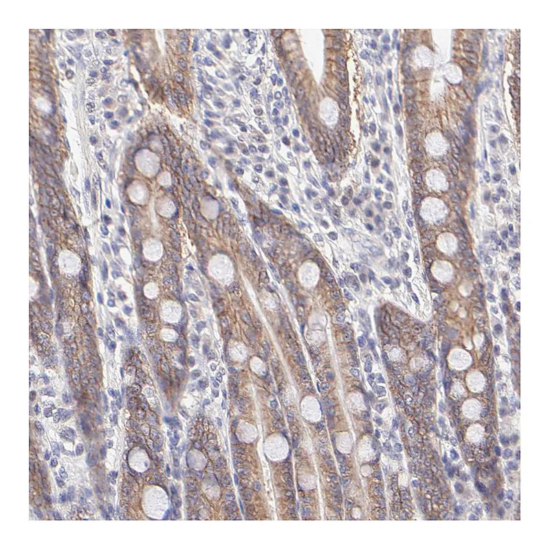 Atlas Antibodies Anti-PBDC1 Antibody