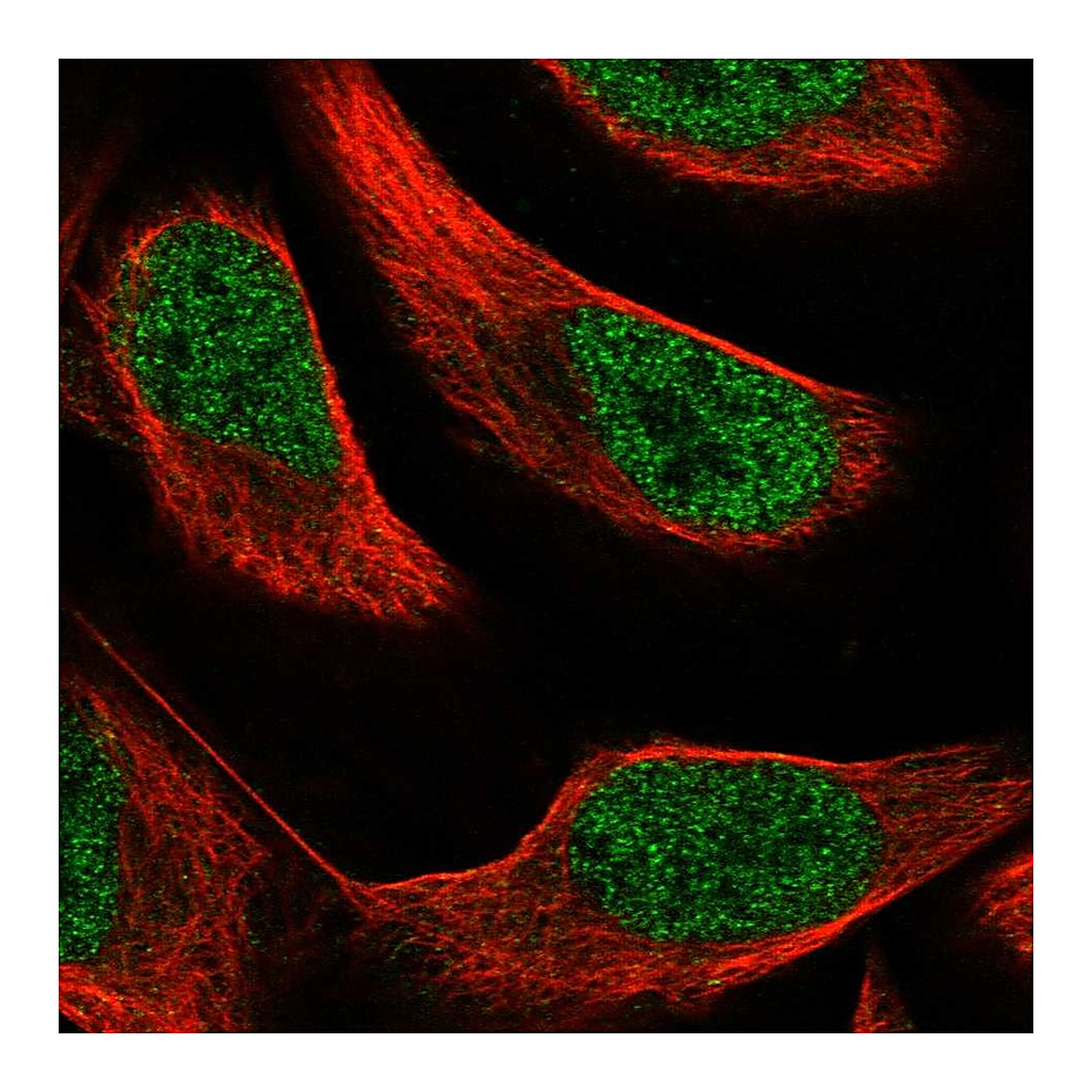 Atlas Antibodies Anti-PAX8 Antibody