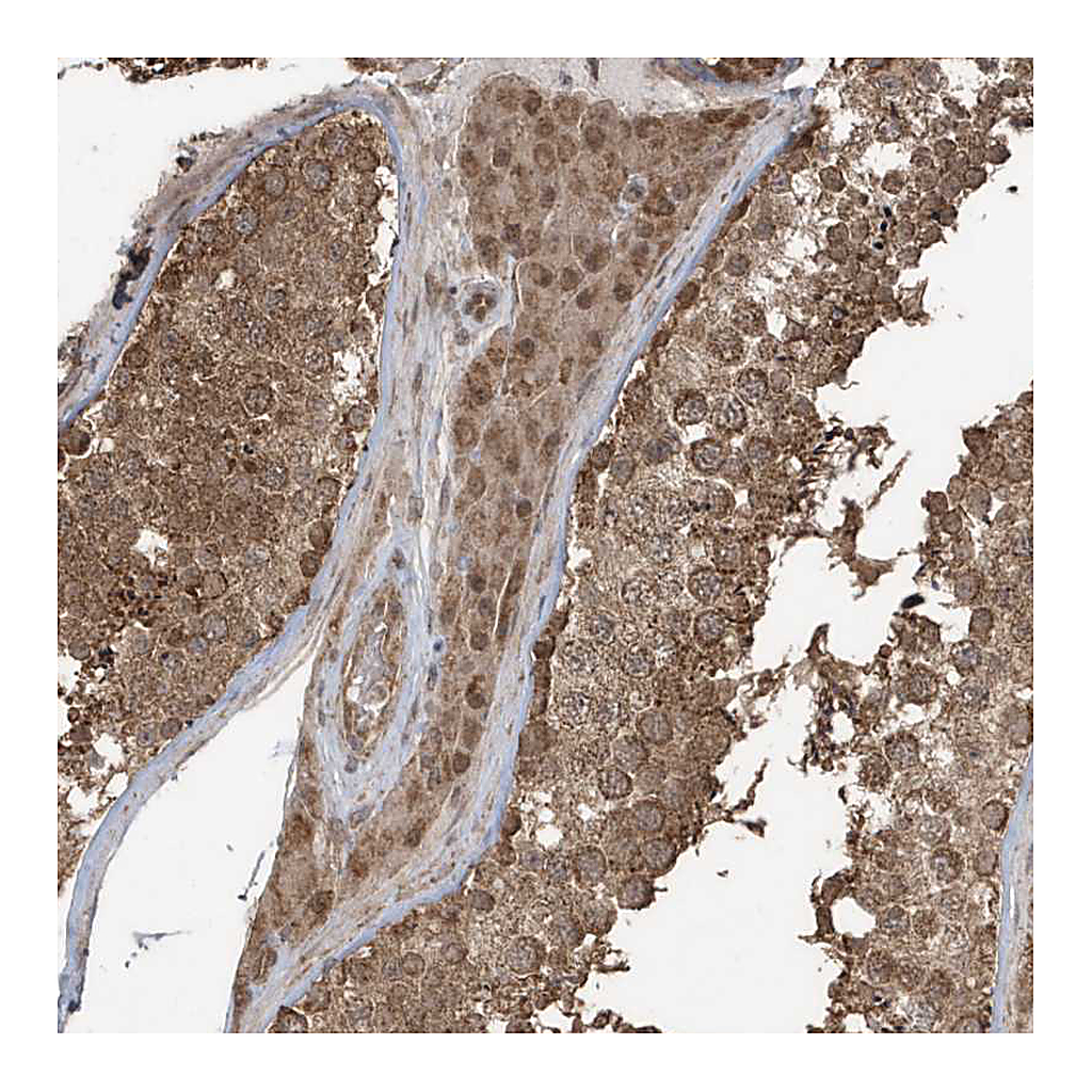 Atlas Antibodies Anti-PAXBP1 Antibody