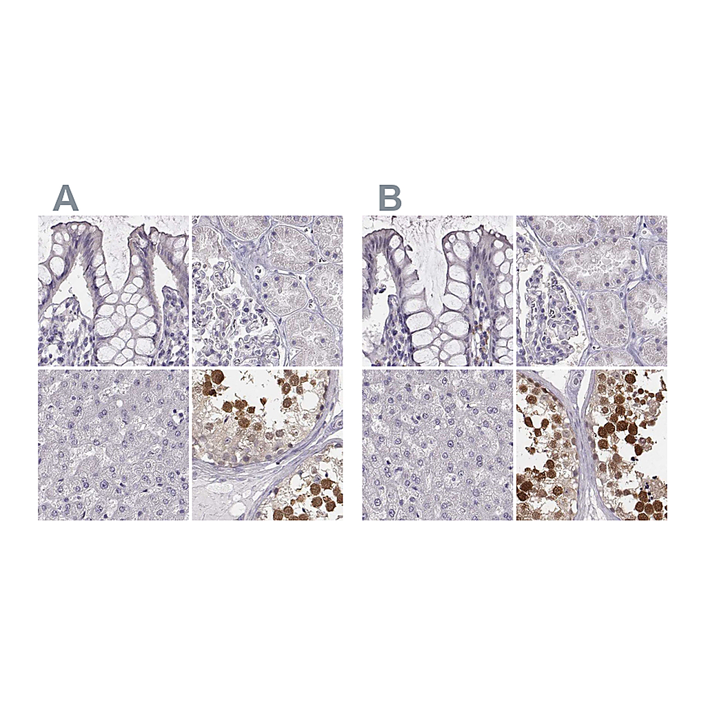 Atlas Antibodies Anti-PBK Antibody