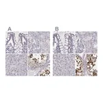 Atlas Antibodies Anti-PBK Antibody