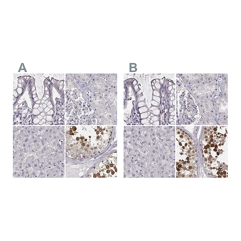 Atlas Antibodies Anti-PBK Antibody