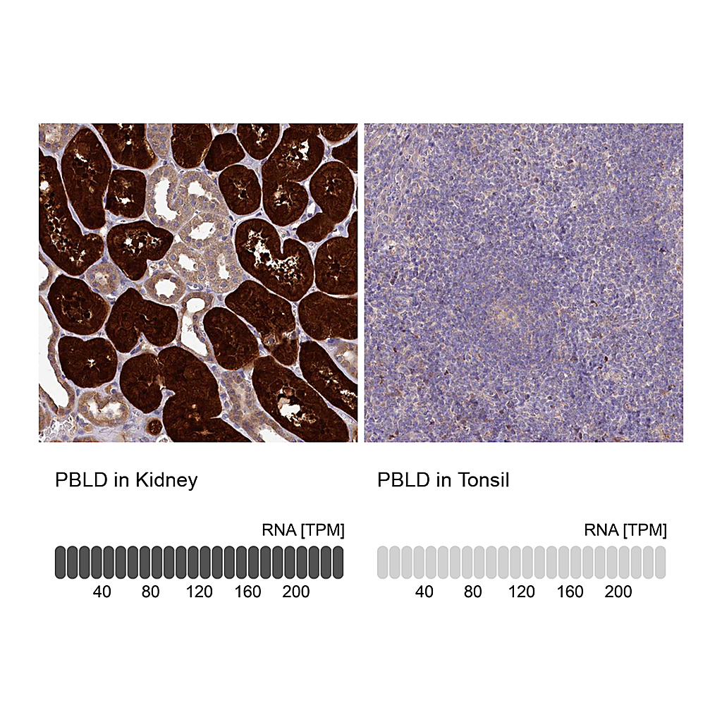 Atlas Antibodies Anti-PBLD Antibody