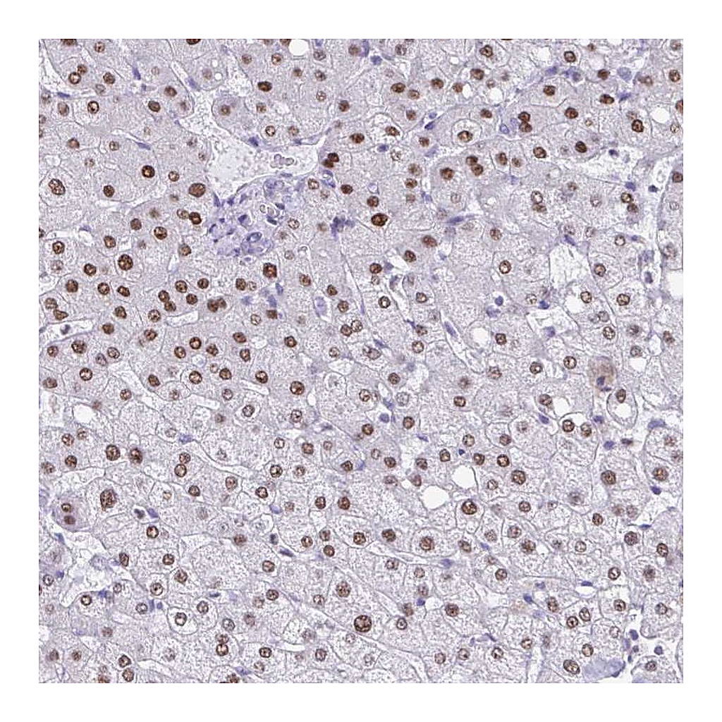 Atlas Antibodies Anti-PBOV1 Antibody