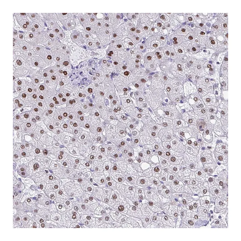 Atlas Antibodies Anti-PBOV1 Antibody