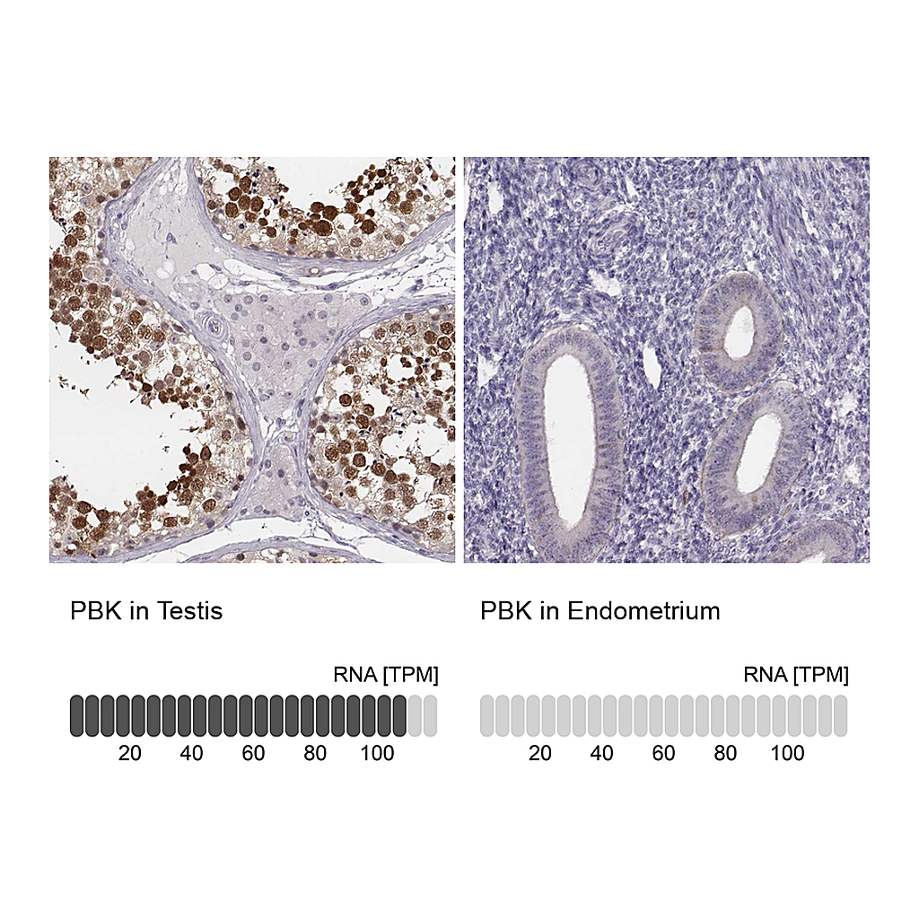 Atlas Antibodies Anti-PBK Antibody
