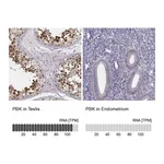 Atlas Antibodies Anti-PBK Antibody