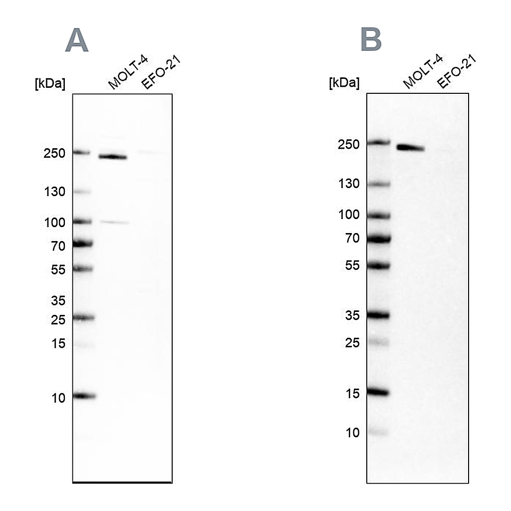 Atlas Antibodies Anti-PBRM1 Antibody