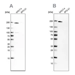 Atlas Antibodies Anti-PBRM1 Antibody