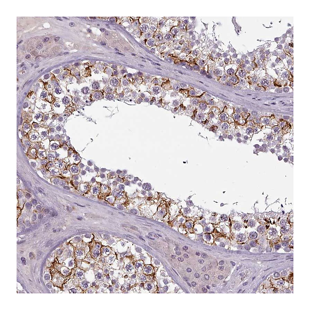 Atlas Antibodies Anti-PBX4 Antibody