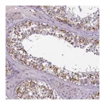 Atlas Antibodies Anti-PBX4 Antibody