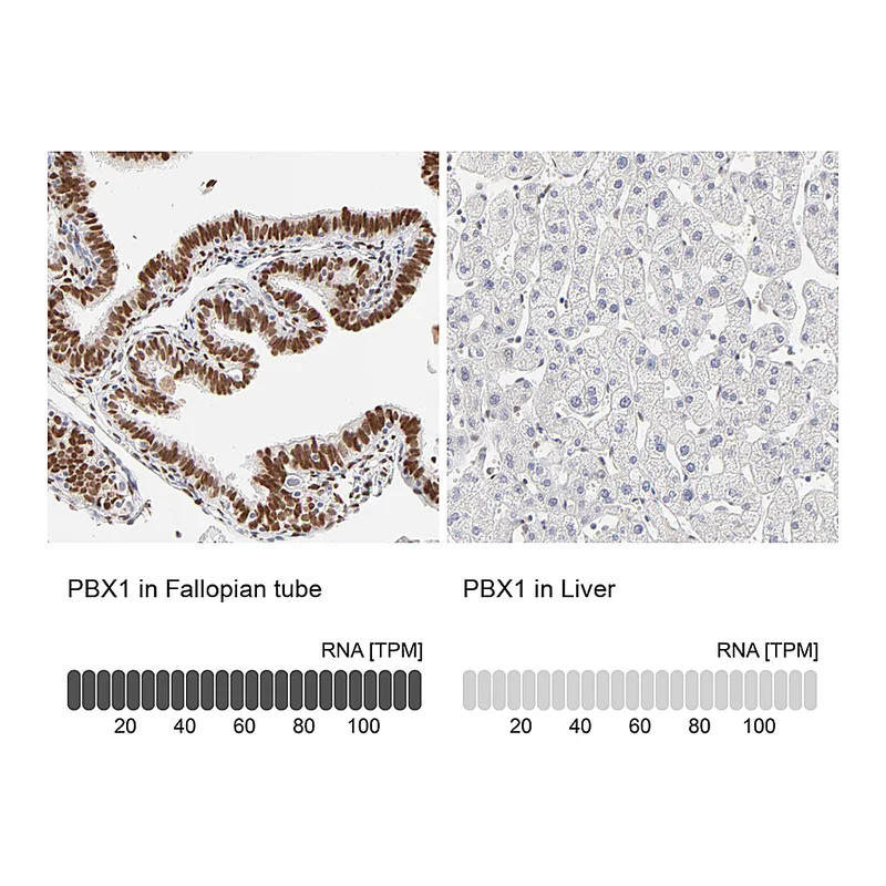 Atlas Antibodies Anti-PBX1 Antibody