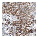Atlas Antibodies Anti-PBXIP1 Antibody