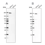 Atlas Antibodies Anti-PBRM1 Antibody