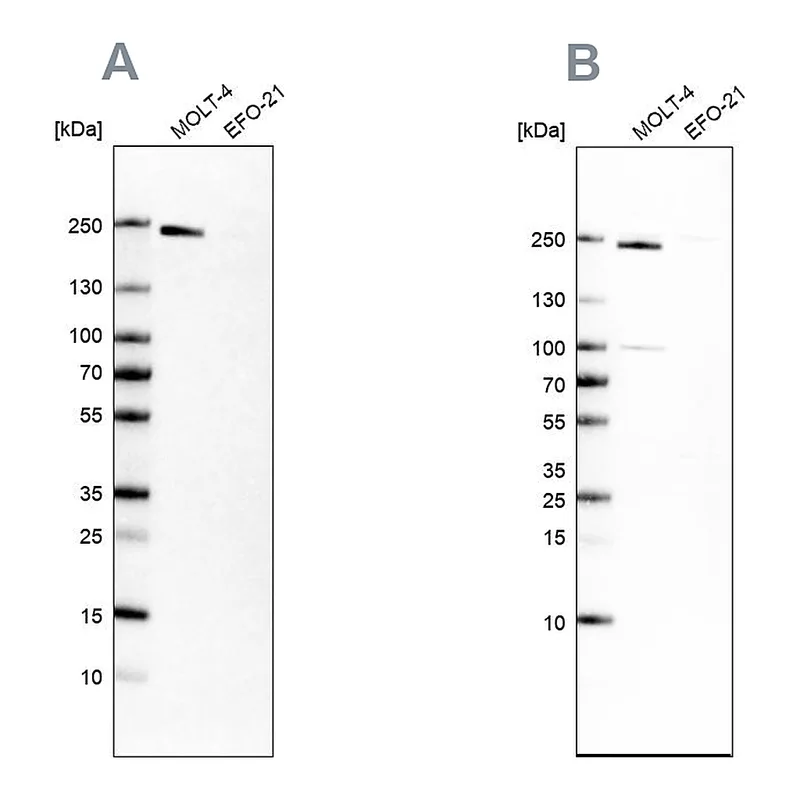 Atlas Antibodies Anti-PBRM1 Antibody