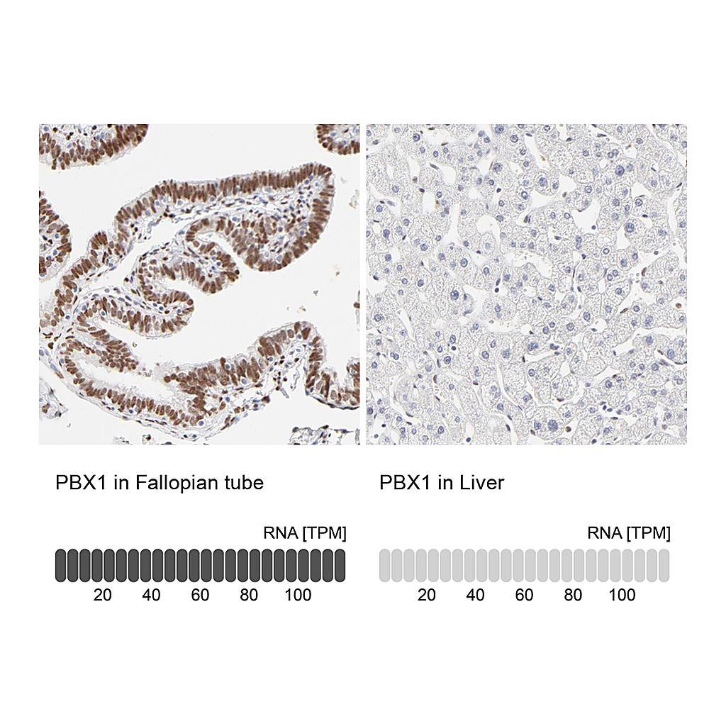 Atlas Antibodies Anti-PBX1 Antibody