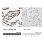 Atlas Antibodies Anti-PBX1 Antibody