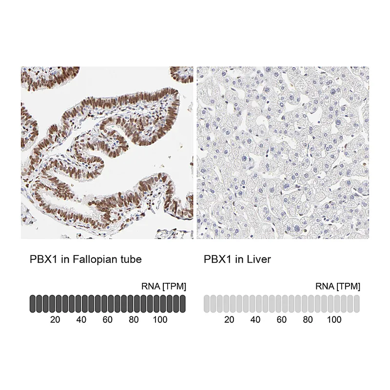 Atlas Antibodies Anti-PBX1 Antibody