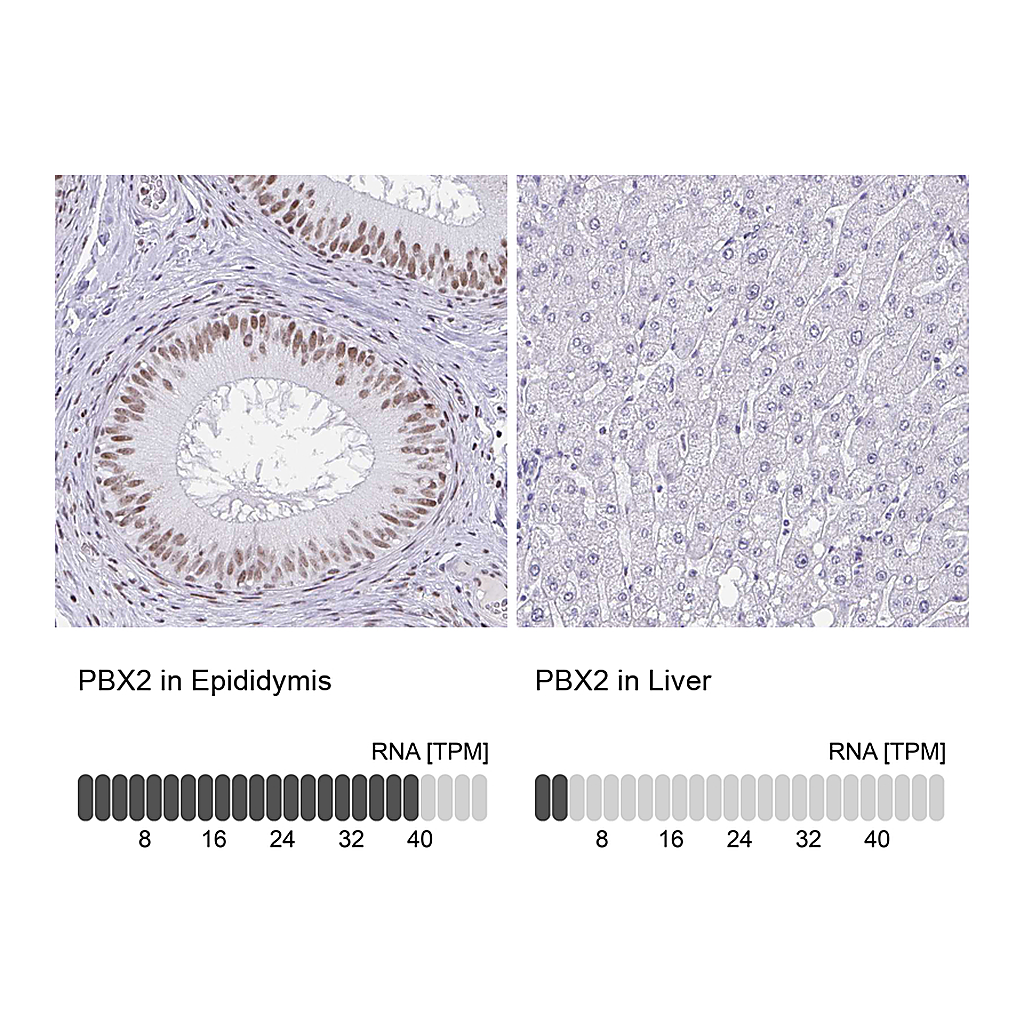 Atlas Antibodies Anti-PBX2 Antibody