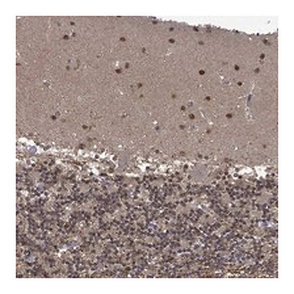 Atlas Antibodies Anti-PCBP2 Antibody