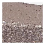 Atlas Antibodies Anti-PCBP2 Antibody