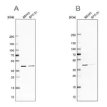 Atlas Antibodies Anti-PCBP1 Antibody